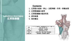 広背筋の痛み 広背筋損傷